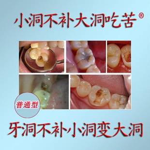 烤瓷牙 自己动手补牙洞材料 粘烤瓷牙胶水牙齿牙科材料增强型包邮 补