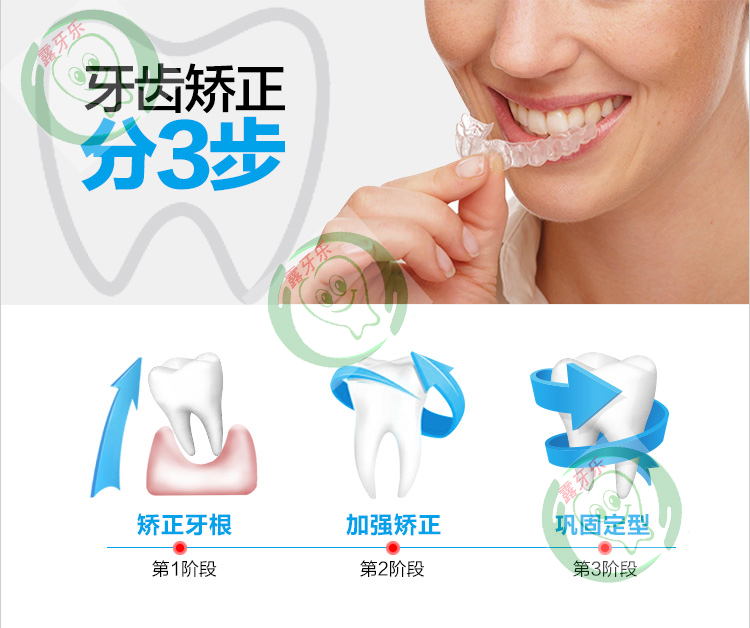 牙齿矫正器 隐形牙套 3d矫正牙齿方案矫正成人儿童正畸地包天牙套