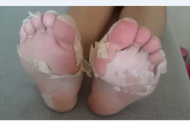 老茧去死皮护理脚丫足足白嫩脱皮脚底足膜脚膜