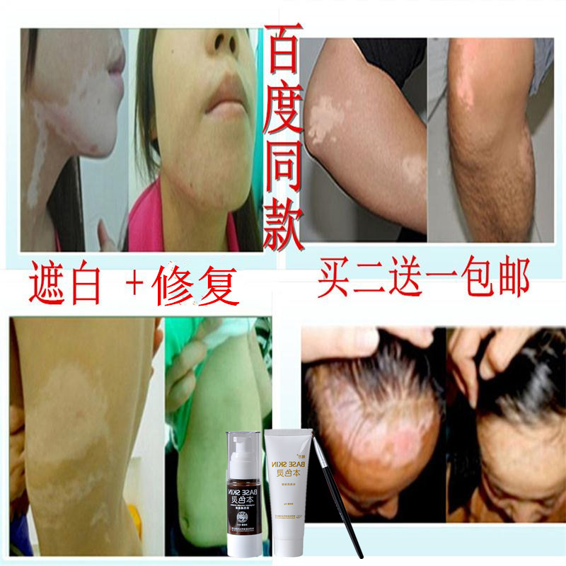 疤痕疙瘩\/烧伤烫伤\/凹疤痘坑\/增生性凸疤\/色素沉