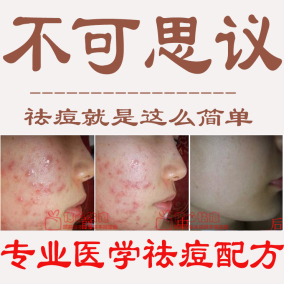 正品[祛脓包]脓包型痤疮评测 头皮上长痘痘和脓包图片_惠惠购物