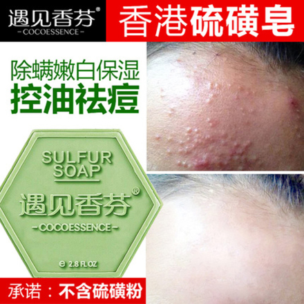 香港遇见香芬硫磺皂 除螨去螨虫 脸部背部祛痘