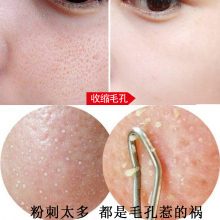 面部提拉紧致补水控油毛孔粗大修复收缩水 女士收缩毛孔精华液男士