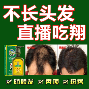 知医堂防脱发生发液增发密发脂溢性产后止脱秃顶浓密增长液