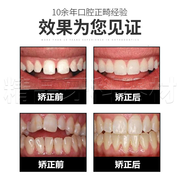 隐形牙套牙齿矫正器成口腔地包天龅牙保持器矫正器儿童透明磨牙套_双