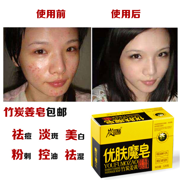 竹炭肥皂包邮祛痘祛印斑保湿姜 含硫磺香皂牛黄 洗脸控油美白除螨