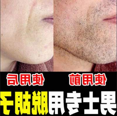 正品[脱毛膏能脱胡子吗]脱毛膏能脱胡子评测 脱
