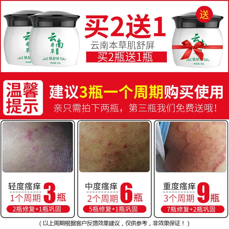 竹福堂止痒膏肛门阴囊外阴肛周痒男女大腿内侧皮肤瘙痒股藓灵乳膏