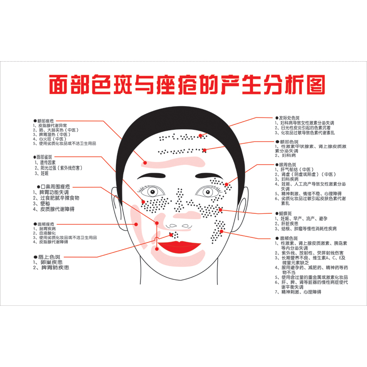 面部色斑与痤疮产生的原因图片 中医美容院养身spa健康宣传海报