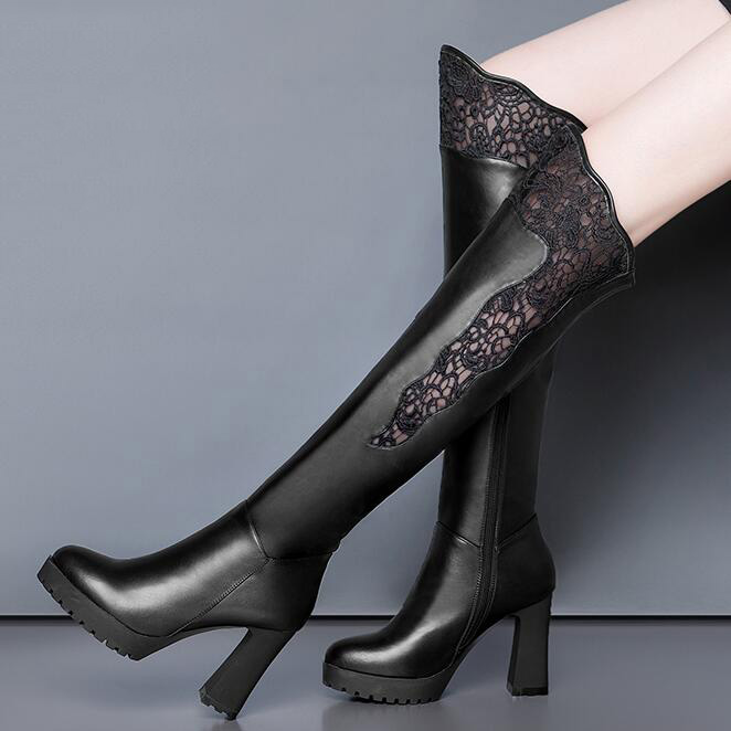 正品[网状青斑吃什么药]网状青斑评测 网状青斑