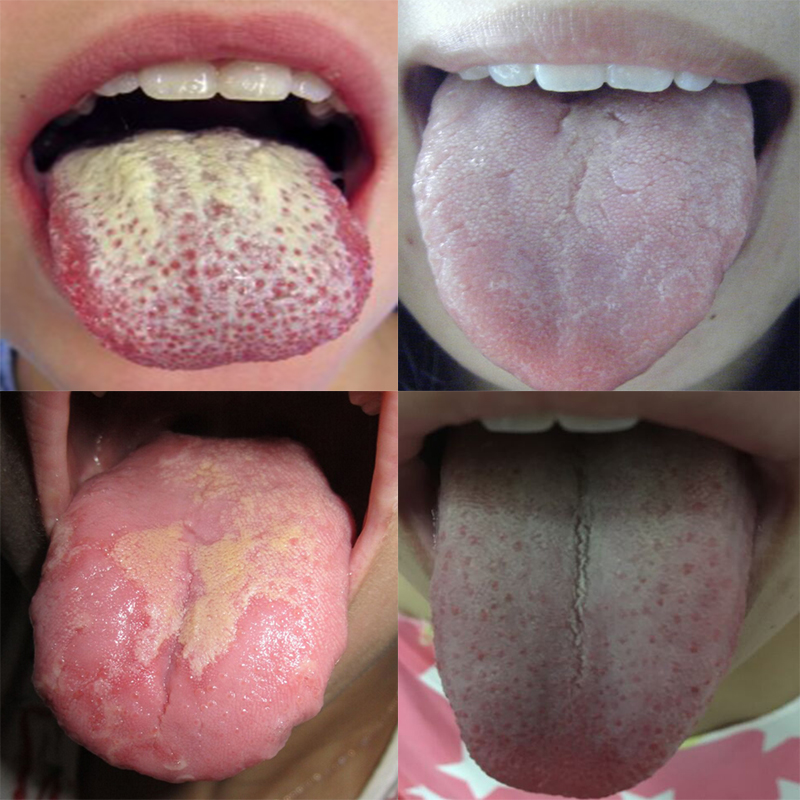 正品[口腔技工钳]康强口腔技工招聘网评测 口腔