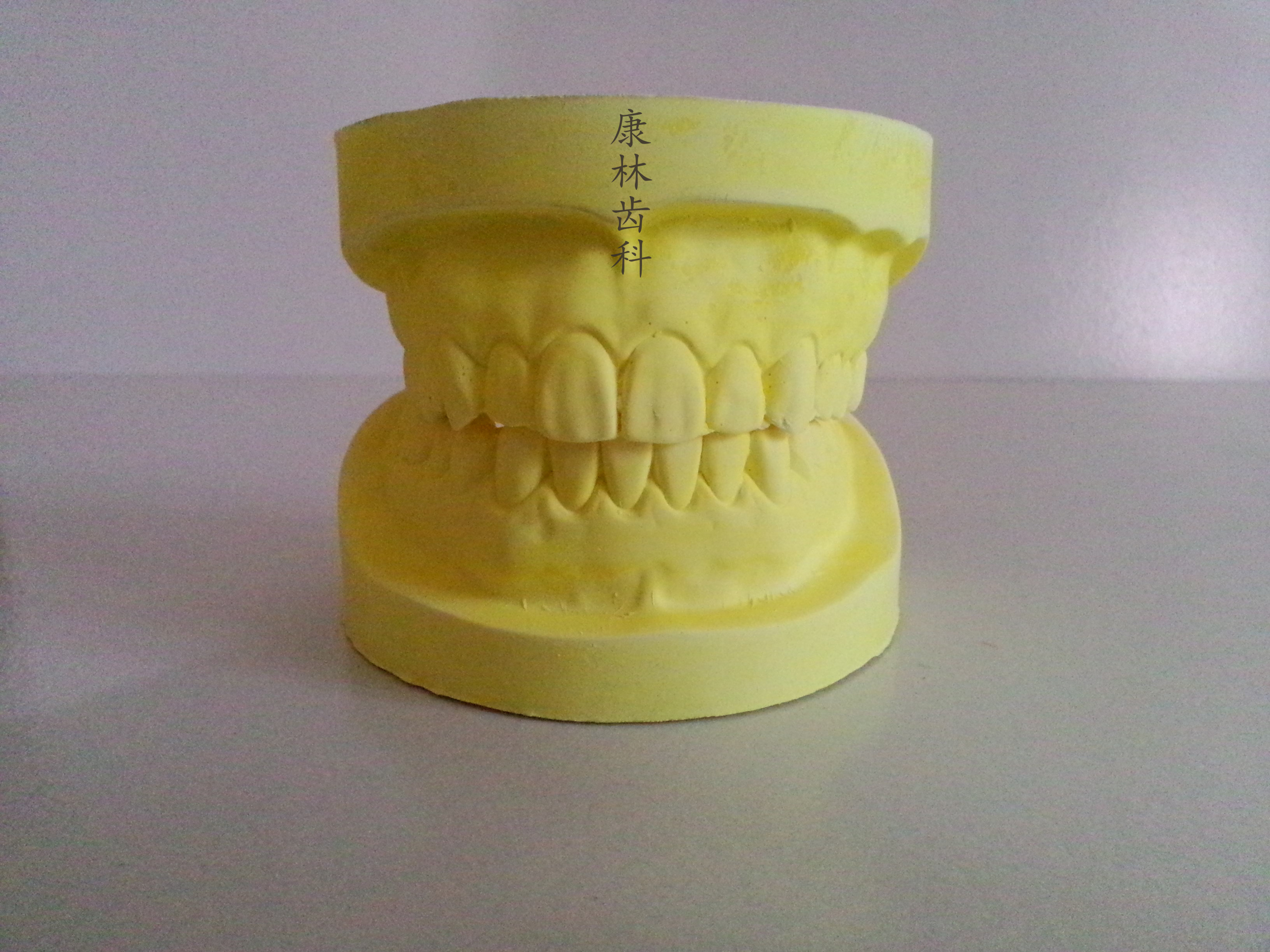 牙科 假牙模型 无牙颌模型 无牙模型 石膏模型