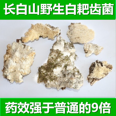 白耙齒菌 腎炎腎小球 iga腎病綜合症 腎衰竭 尿毒症 腎功能不全