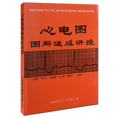 【心电图诊断手册】(彩图版) 心电图速读 心电图书籍 心电图图解速成
